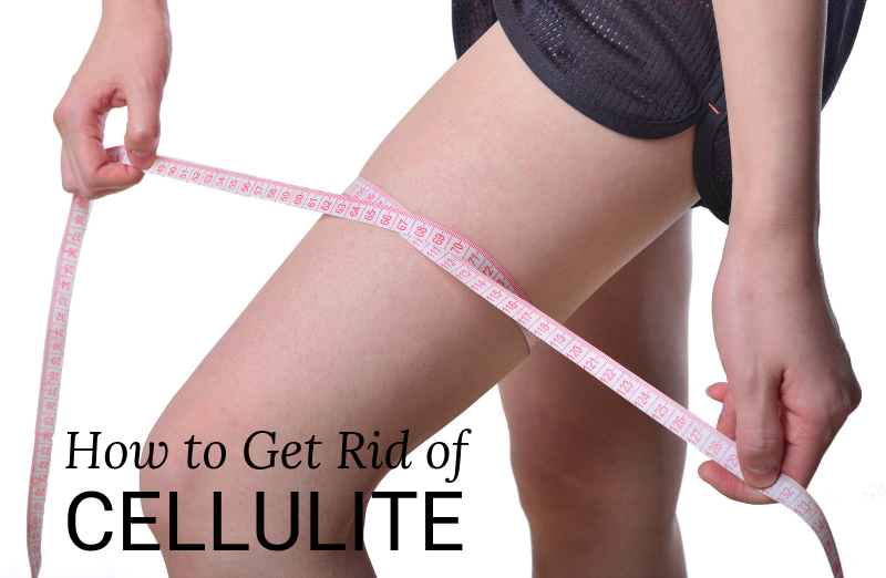 cellulite