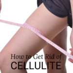 cellulite