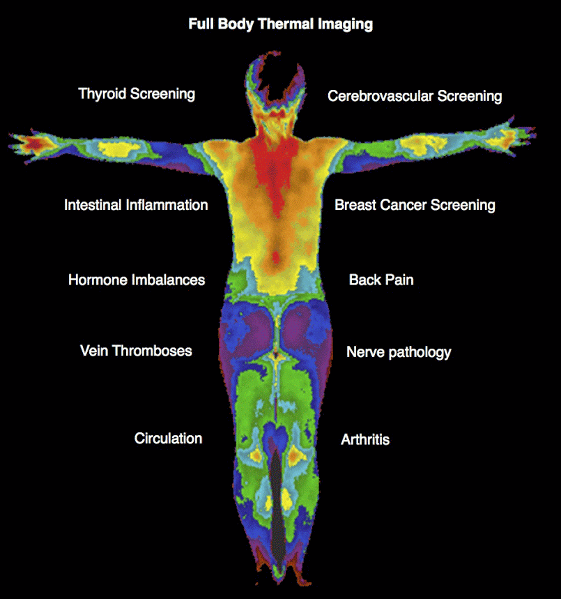 thermography